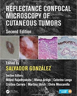 Reflectance Confocal Microscopy of Cutaneous Tumors 2nd Edition