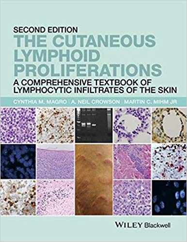 The Cutaneous Lymphoid Proliferations 2nd Edition