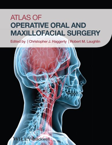 Atlas of Operative Oral and Maxillofacial Surgery 1st Edition