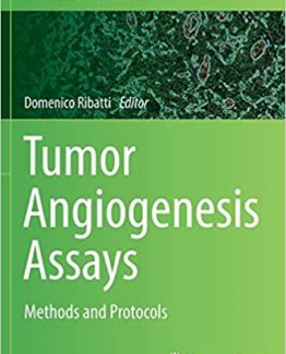 Tumor Angiogenesis Assays Methods and Protocols