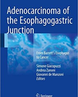 Adenocarcinoma of the Esophagogastric Junction by Simone Giacopuzzi