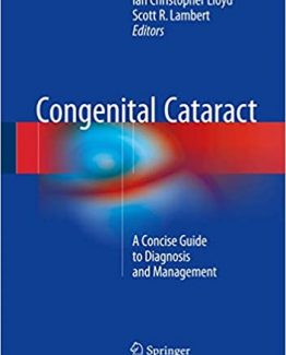 Congenital Cataract A Concise Guide to Diagnosis and Management