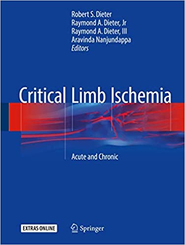 Critical Limb Ischemia Acute and Chronic by Robert S. Dieter