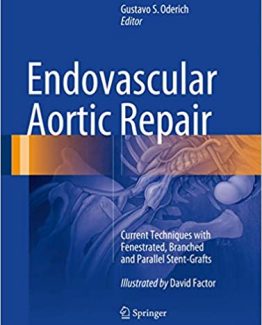 Endovascular Aortic Repair by Gustavo S. Oderich