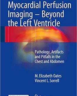 Myocardial Perfusion Imaging Beyond the Left Ventricle
