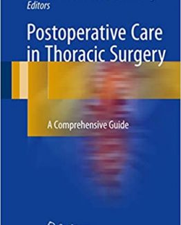 Postoperative Care in Thoracic Surgery A Comprehensive Guide