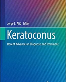 Keratoconus Recent Advances in Diagnosis and Treatment