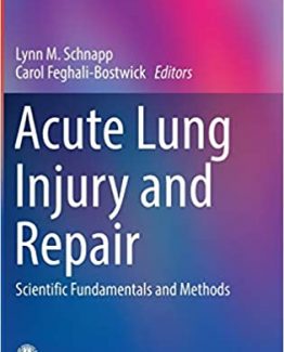 Acute Lung Injury and Repair Scientific Fundamentals and Methods