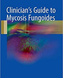 Clinician's Guide to Mycosis Fungoides 2017 Edition