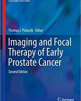 Imaging and Focal Therapy of Early Prostate Cancer 2nd Edition by Thomas J. Polascik