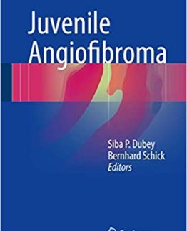 Juvenile Angiofibroma 2017 Edition by Siba P. Dubey
