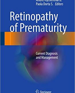 Retinopathy of Prematurity Current Diagnosis and Management