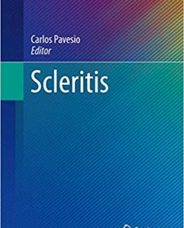 Scleritis (Essentials in Ophthalmology) 2017 Edition by Carlos Pavesio