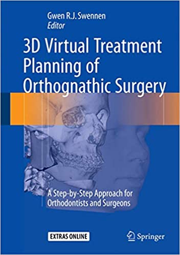 3D Virtual Treatment Planning of Orthognathic Surgery by Gwen Swennen
