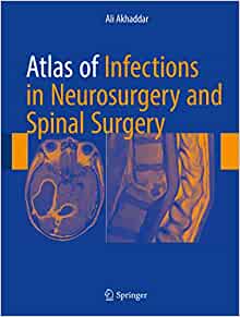 Atlas of Infections in Neurosurgery and Spinal Surgery 1st Edition