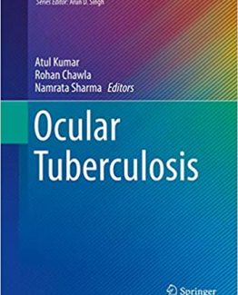 Ocular Tuberculosis 2017 Edition by Atul Kumar