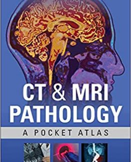 CT & MRI Pathology A Pocket Atlas 3rd Edition by Michael Grey
