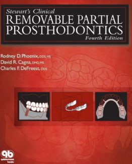 Stewart's Clinical Removable Partial Prosthodontics 4th Edition by Rodney D. Phoenix