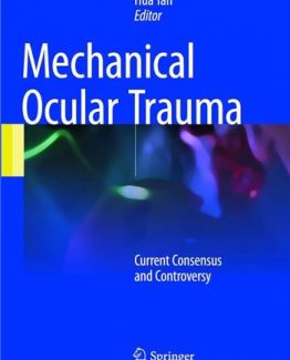 Mechanical Ocular Trauma Current Consensus and Controversy 2017 Edition by Hua Yan