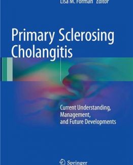 Primary Sclerosing Cholangitis Current Understanding Management and Future Developments