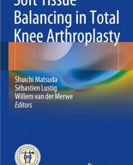 Soft Tissue Balancing in Total Knee Arthroplasty by Shuichi Matsuda