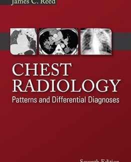 Chest Radiology Patterns and Differential Diagnoses 7th Edition by James C. Reed