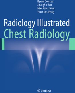 Radiology Illustrated Chest Radiology 2014th Edition by Kyung Soo Lee