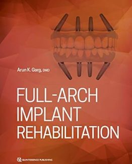 Full-Arch Implant Rehabilitation 1st Edition by Arun K. Garg