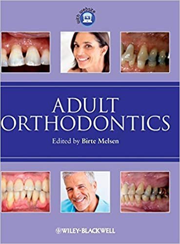 Adult Orthodontics by Birte Melsen, ISBN-13: 978-1405136198