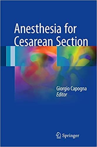Anesthesia for Cesarean Section by Giorgio Capogna, ISBN-13: 978-3319420516