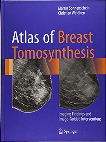 Atlas of Breast Tomosynthesis: Imaging Findings and Image-Guided Interventions, ISBN-13: 978-3319215655