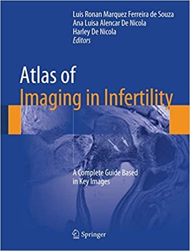 Atlas of Imaging in Infertility: A Complete Guide Based in Key Images, ISBN-13: 978-3319138923