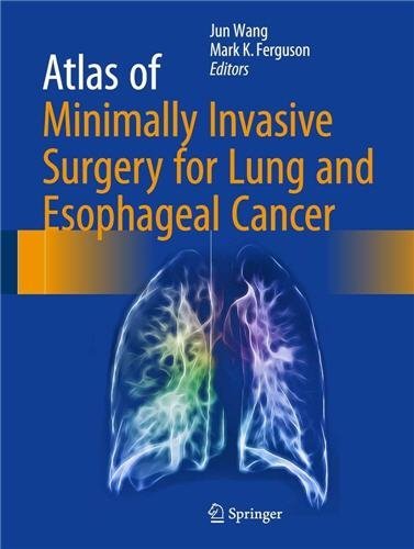Atlas of Minimally Invasive Surgery for Lung and Esophageal Cancer, ISBN-13: 978-9402408331