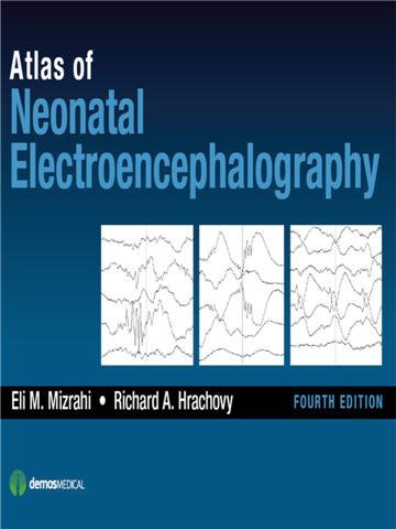 Atlas of Neonatal Electroencephalography 4th Edition by Eli M. Mizrahi, ISBN-13: 978-1620700679