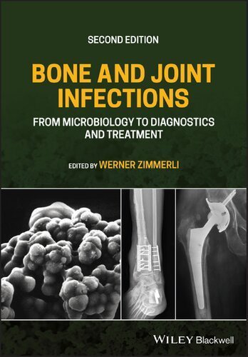 Bone and Joint Infections: From Microbiology to Diagnostics and Treatment 2nd Edition by Werner Zimmerli, ISBN-13: 978-1119720652