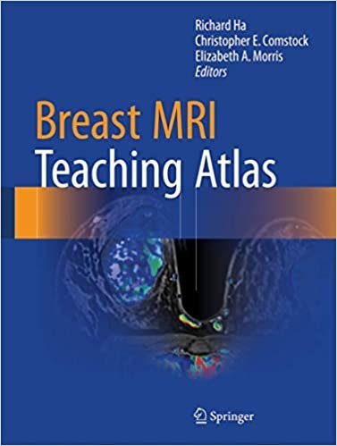 Breast MRI Teaching Atlas 2017 Edition by Richard Ha, ISBN-13: 978-1493964079