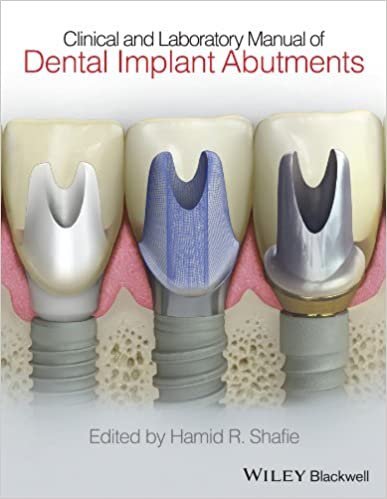 Clinical and Laboratory Manual of Dental Implant Abutments, ISBN-13: 978-1119949817