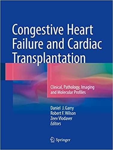 Congestive Heart Failure and Cardiac Transplantation, ISBN-13: 978-3319445755