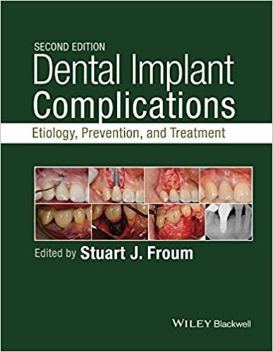 Dental Implant Complications: Etiology, Prevention, and Treatment 2nd Edition, ISBN-13: 978-1118976456