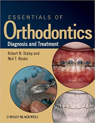 Essentials of Orthodontics: Diagnosis and Treatment, ISBN-13: 978-0813808680