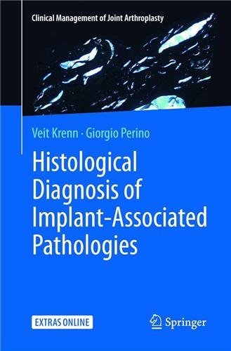 Histological Diagnosis of Implant-associated Pathologies by Veit Krenn, ISBN-13: 978-3662571880