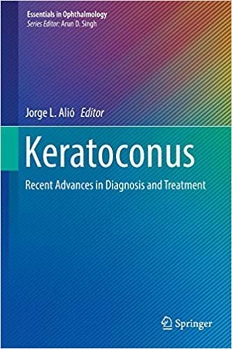 Keratoconus: Recent Advances in Diagnosis and Treatment, ISBN-13: 978-3319438795