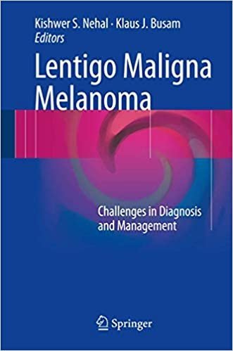 Lentigo Maligna Melanoma: Challenges in Diagnosis and Management, ISBN-13: 978-3319437859