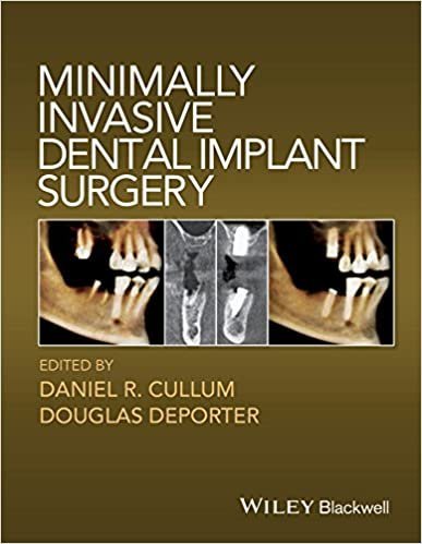 Minimally Invasive Dental Implant Surgery by Daniel R. Cullum, ISBN-13: 978-0813814520