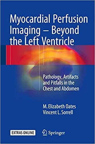 Myocardial Perfusion Imaging - Beyond the Left Ventricle by M. Elizabeth Oates, ISBN-13: 978-3319254340