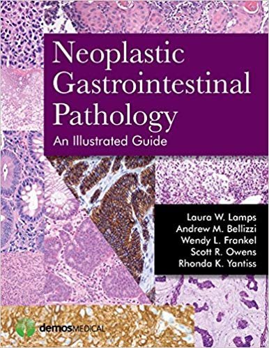 Neoplastic Gastrointestinal Pathology: An Illustrated Guide, ISBN-13: 978-1936287727