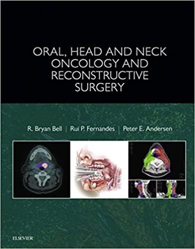 Oral, Head and Neck Oncology and Reconstructive Surgery, ISBN-13: 978-0323265683