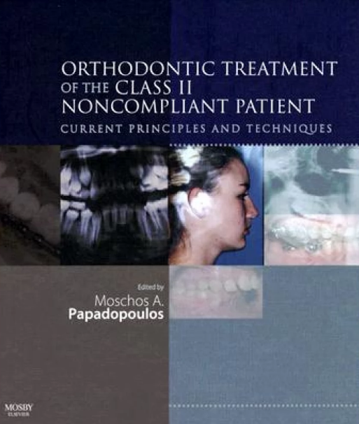 Orthodontic Treatment of the Class II Noncompliant Patient, ISBN-13: 978-0723433910