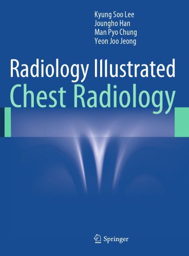 Radiology Illustrated: Chest Radiology 2014th Edition by Kyung Soo Lee, ISBN-13: 978-3642370953