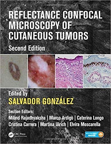 Reflectance Confocal Microscopy of Cutaneous Tumors 2nd Edition, ISBN-13: 978-1498757607